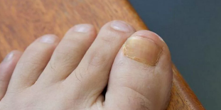 Anerer sprooch liesen